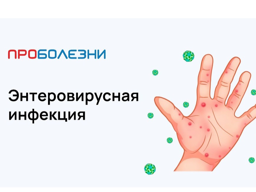 Энтеровирусная инфекция.